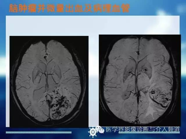自动草稿