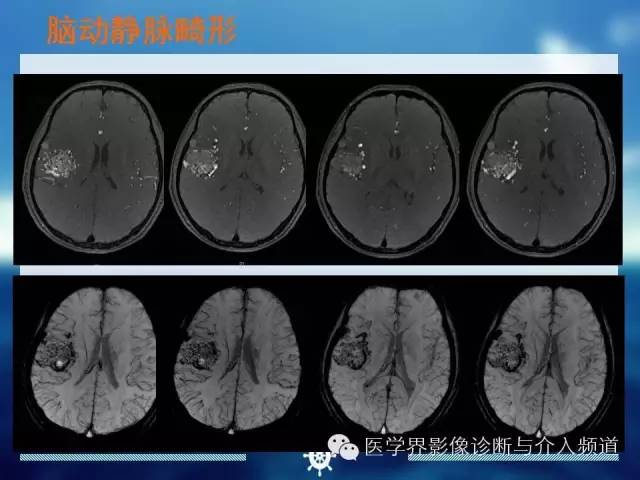 自动草稿