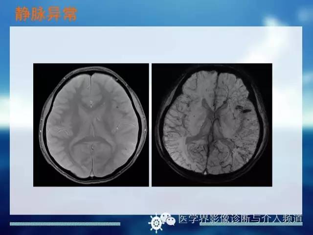 自动草稿