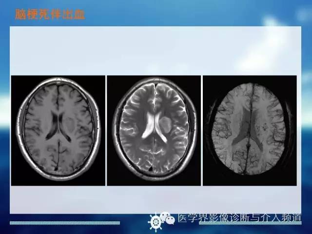 自动草稿