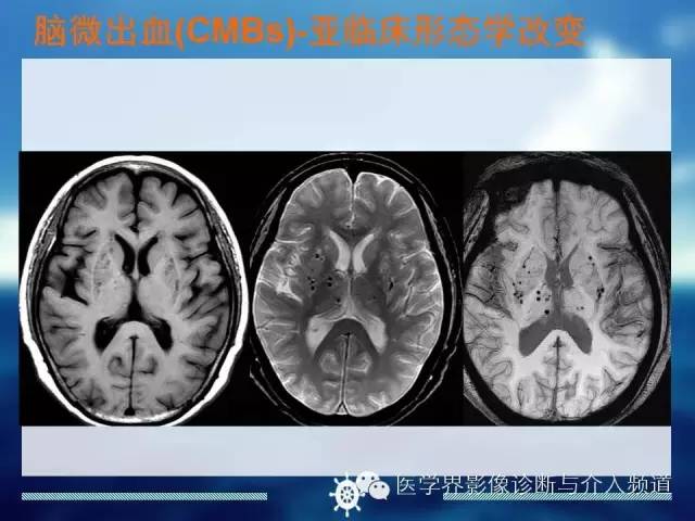 自动草稿