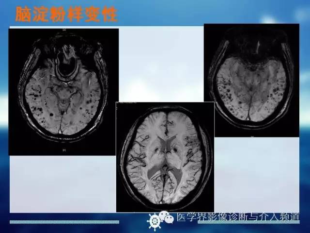 自动草稿