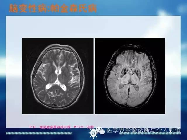 自动草稿