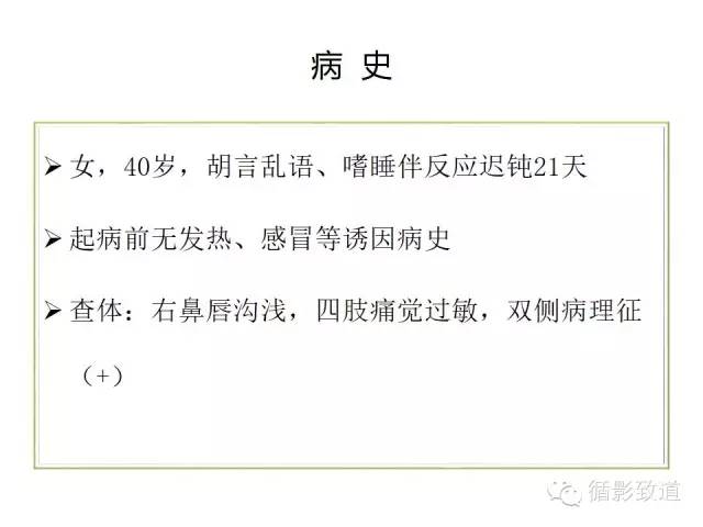 【病例】视神经脊髓炎谱系病1例MR影像表现