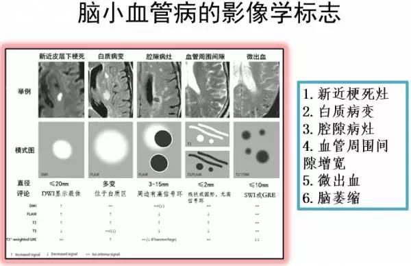 一图读懂被很多医生误诊、漏诊的脑小血管病
