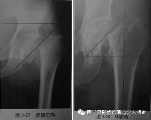 骨盆X片，这些径线你还记得吗？