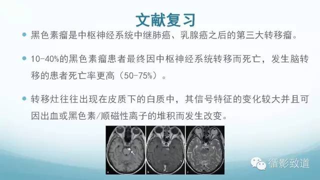 【病例】脑内黑色素瘤转移瘤1例影像表现