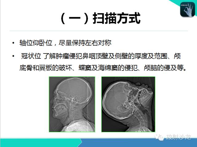 【PPT】鼻咽部CT解剖