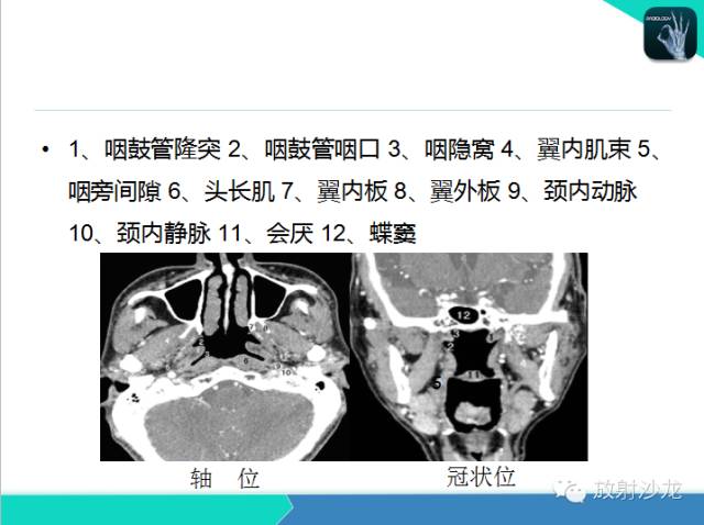 【PPT】鼻咽部CT解剖