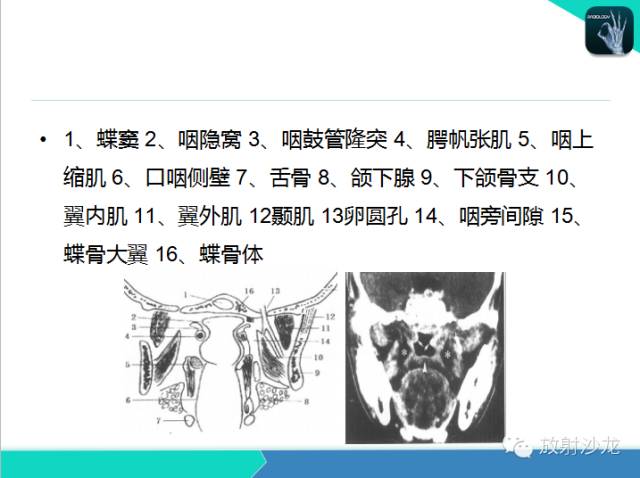 【PPT】鼻咽部CT解剖