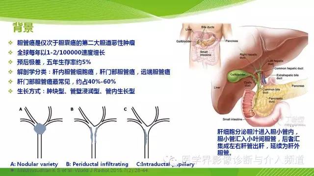 【PPT】肝门部胆管癌的影像诊断与介入治疗