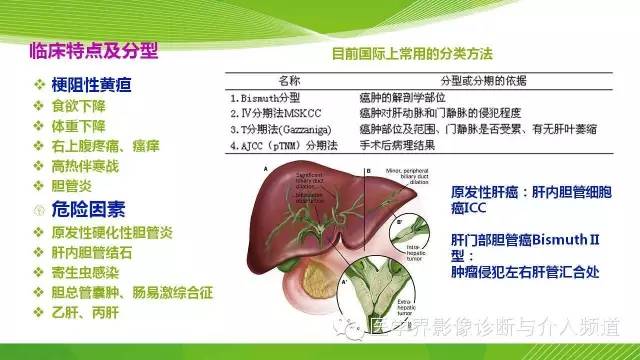 【PPT】肝门部胆管癌的影像诊断与介入治疗