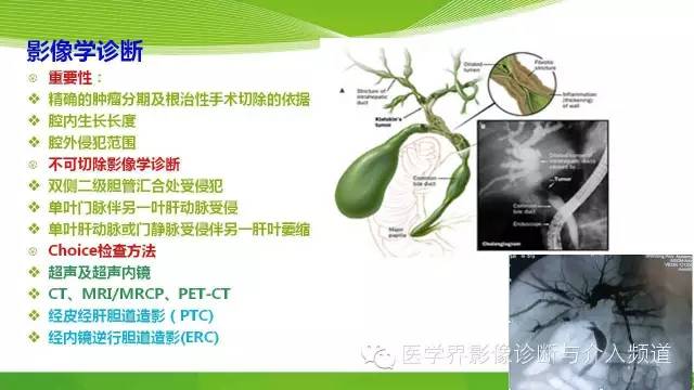 【PPT】肝门部胆管癌的影像诊断与介入治疗