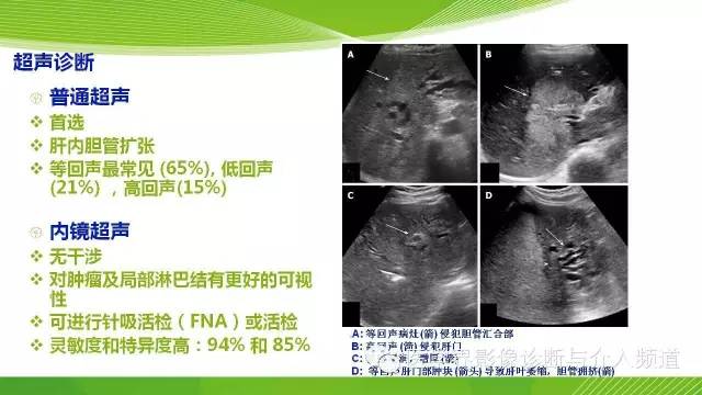 【PPT】肝门部胆管癌的影像诊断与介入治疗