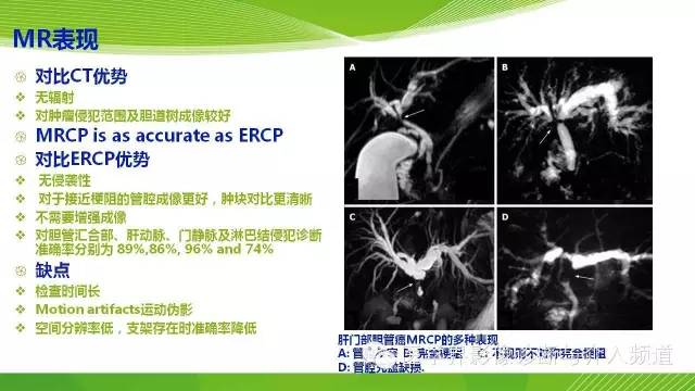 【PPT】肝门部胆管癌的影像诊断与介入治疗
