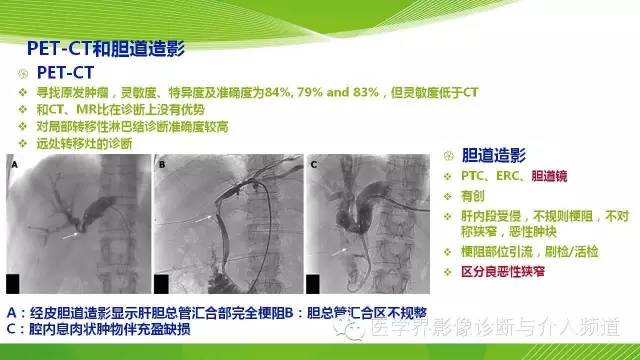 【PPT】肝门部胆管癌的影像诊断与介入治疗