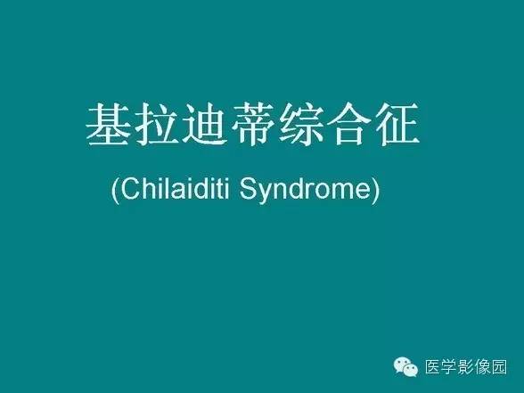 【PPT】基拉迪蒂综合征