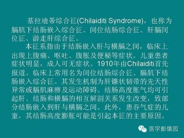 【PPT】基拉迪蒂综合征
