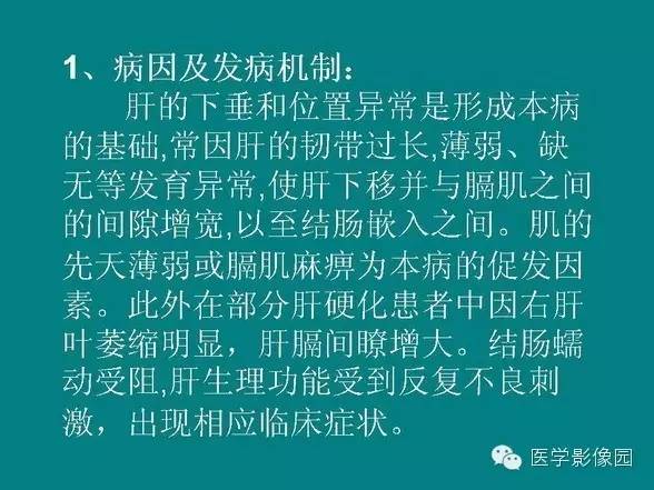【PPT】基拉迪蒂综合征