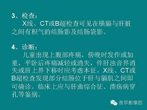 【PPT】基拉迪蒂综合征