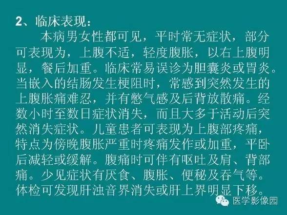 【PPT】基拉迪蒂综合征