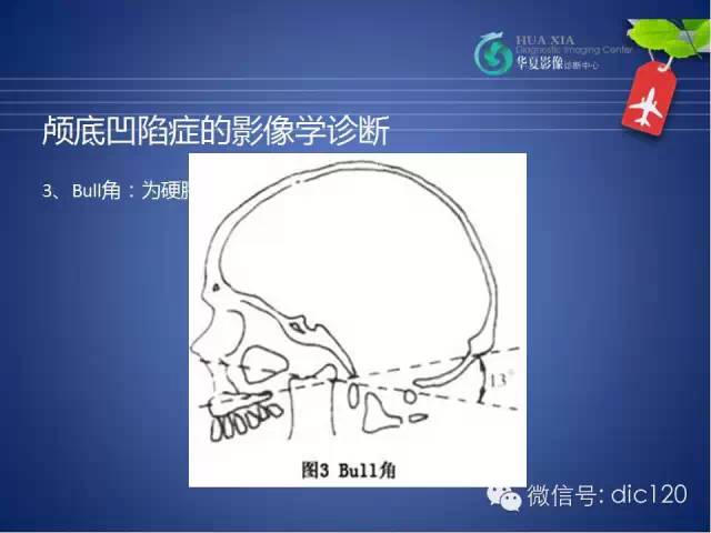 【PPT】原发性颅底凹陷症的影像学诊断