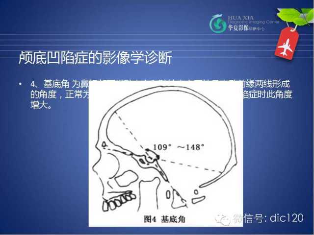 【PPT】原发性颅底凹陷症的影像学诊断