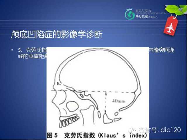 【PPT】原发性颅底凹陷症的影像学诊断