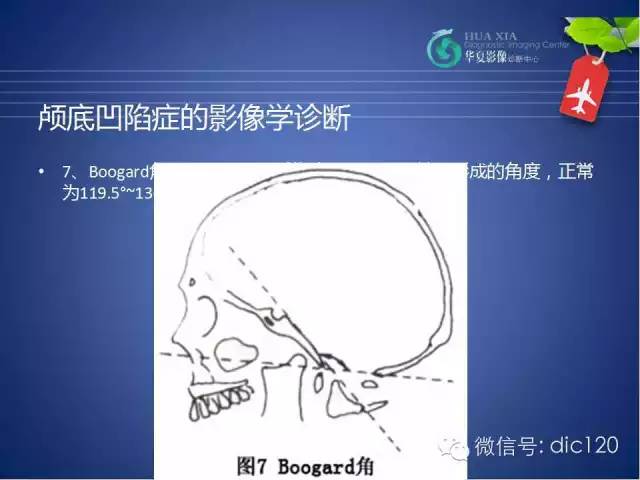 【PPT】原发性颅底凹陷症的影像学诊断