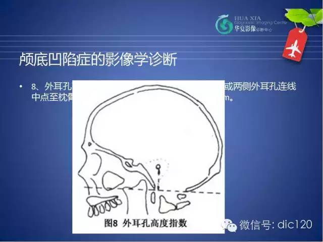 【PPT】原发性颅底凹陷症的影像学诊断