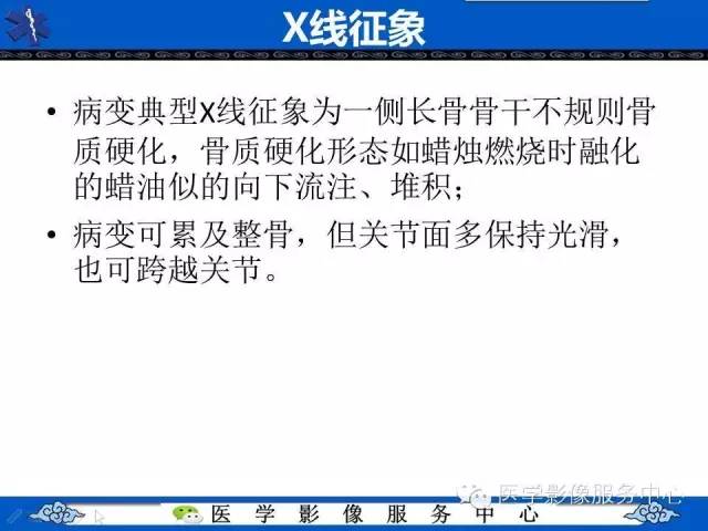 【影像征象】滴蜡征——蜡泪样骨病