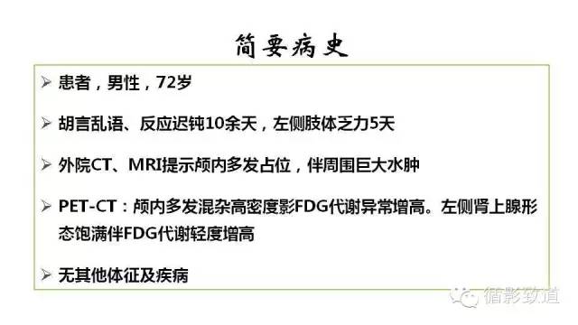 【病例】中枢神经系统淋巴瘤1例MR影像表现
