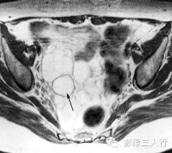 自动草稿