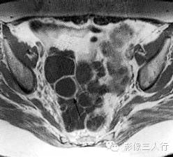 自动草稿 自动草稿