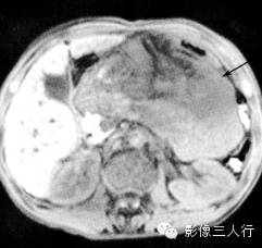 自动草稿 自动草稿