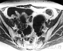 自动草稿 自动草稿