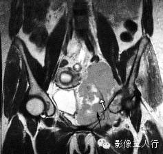 自动草稿 自动草稿