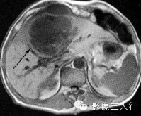 自动草稿 自动草稿
