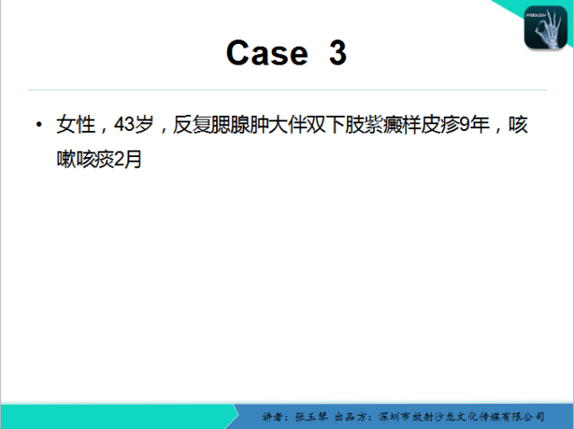 【PPT】腮腺MRI检查对干燥综合征SS的诊断价值