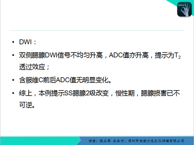 【PPT】腮腺MRI检查对干燥综合征SS的诊断价值