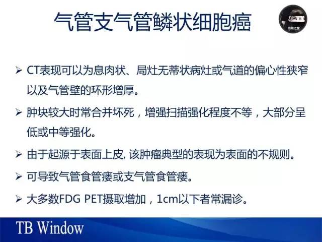 【PPT】气管支气管肿瘤文献回顾