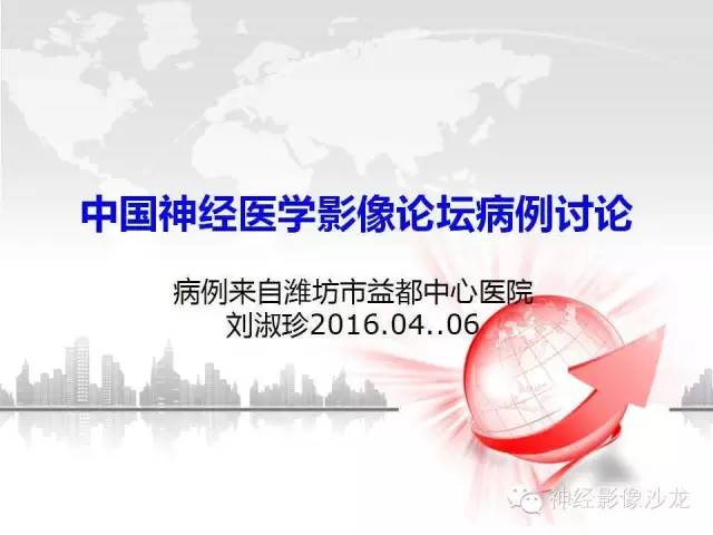 【病例】颅底炎性假瘤1例CT及MR影像表现