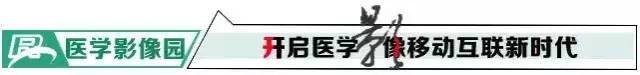 【病例】胼胝体缺如 【病例】胼胝体缺如