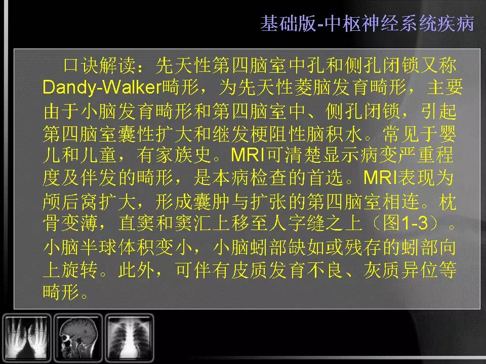 【PPT】先天性第四脑室中孔和侧孔闭锁