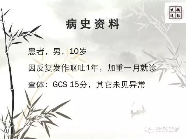 【病例】促纤维增生型髓母细胞瘤1例MR影像表现