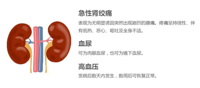 无手术无伤痕,肾脏就这样“消失”了…… 无手术无伤痕,肾脏就这样“消失”了……