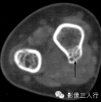 自动草稿