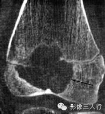 自动草稿 自动草稿