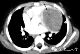 自动草稿 自动草稿
