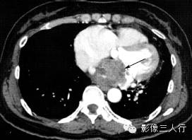 自动草稿 自动草稿